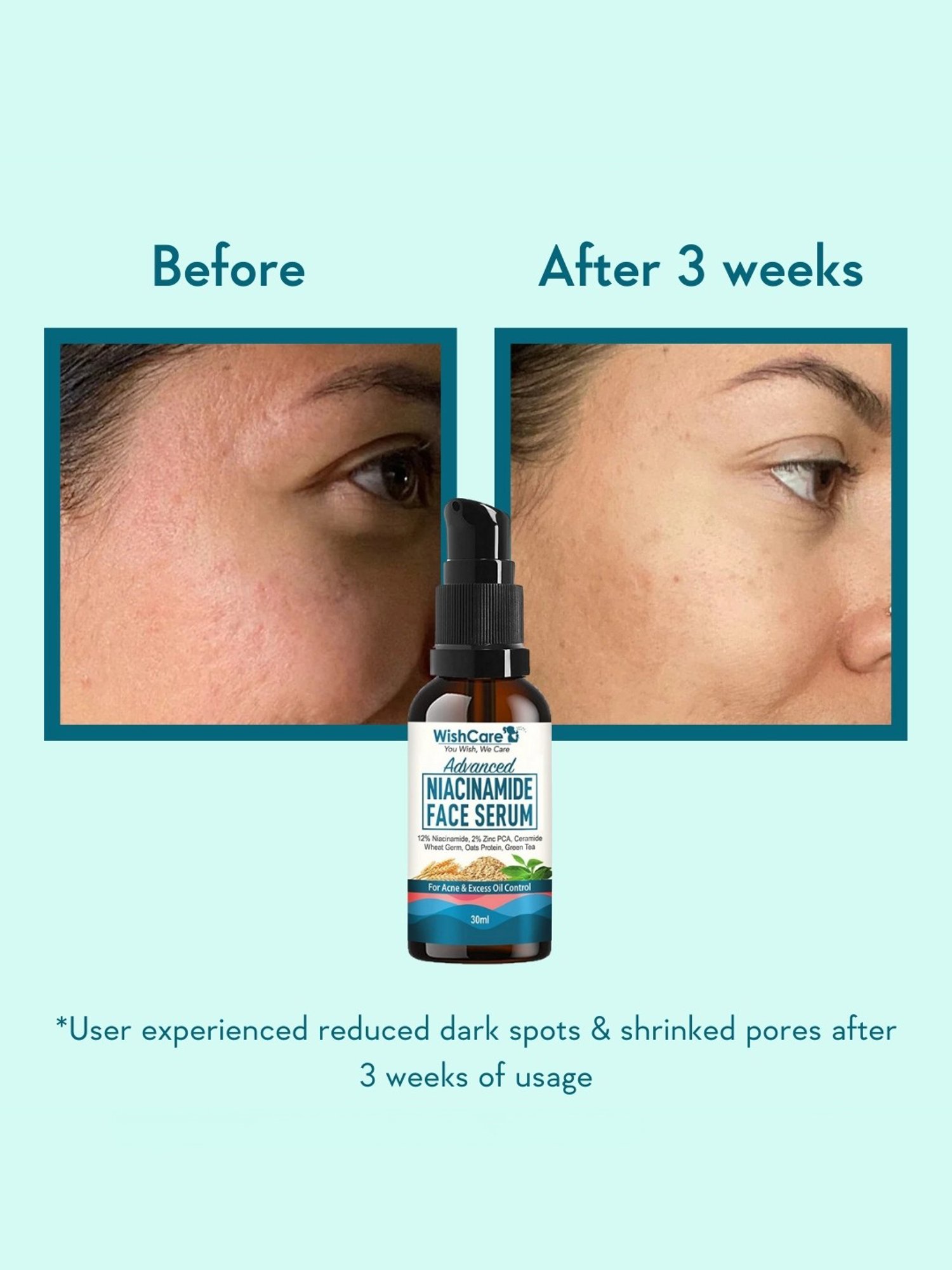 Wishcare Advanced Niacinamide Face Serum - 30 ml