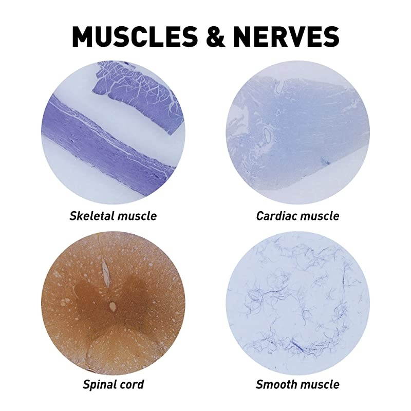 Mega Biology Set Professional Grade Specimens 25 Prepared Microscope Slides Detailed Learning Guide and Storage Box