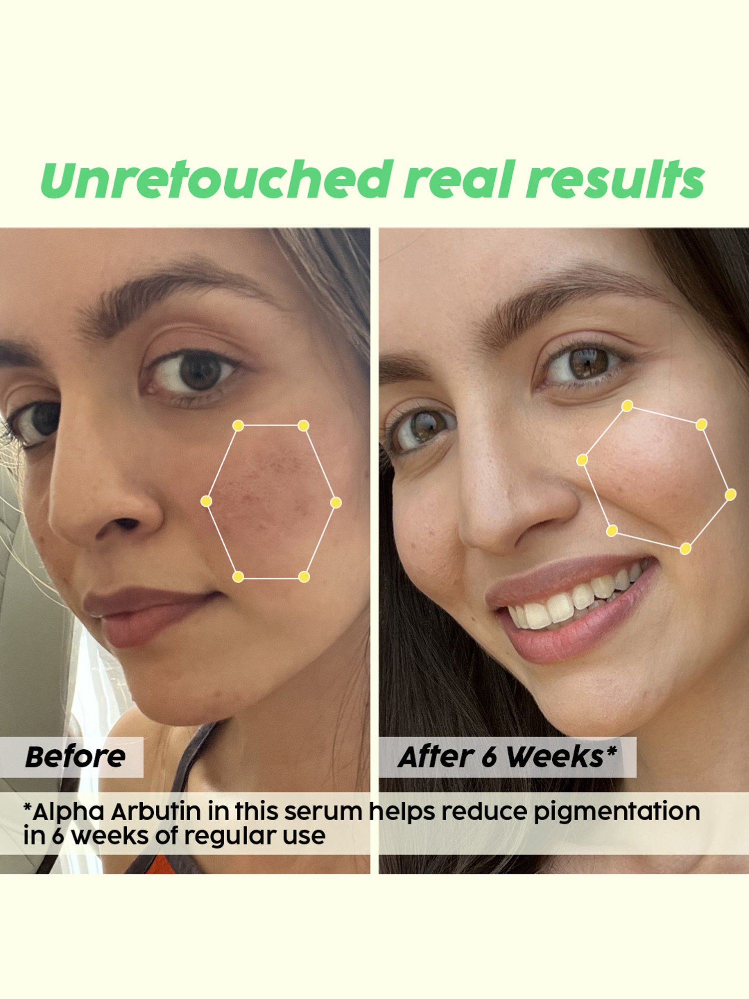 PLIX THE PLANT FIX Pineapple De-Pigmentation Dewy Serum - 30 ml