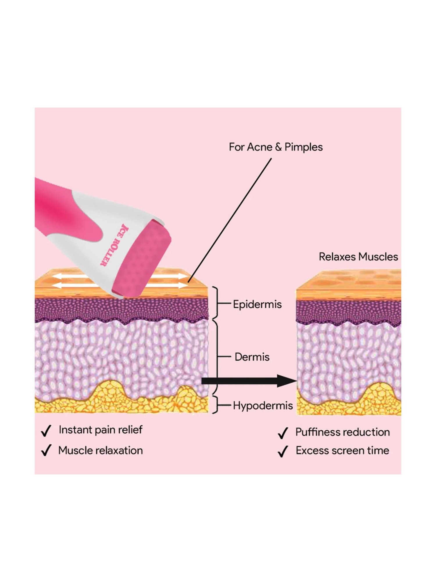 House of Beauty Pink Ice Roller - 187 gm