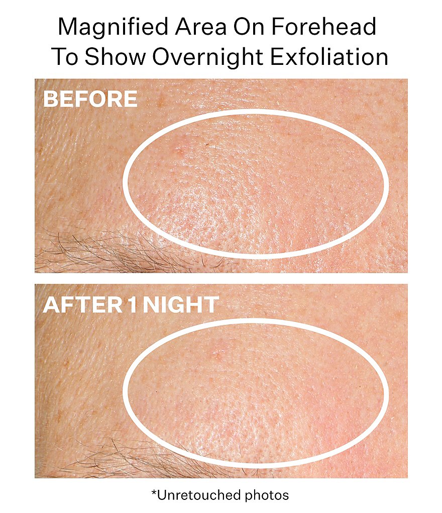 StriVectin Lactic Acid Nightly Retexturizing Serum