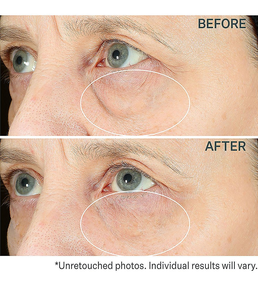 StriVectin Hyperlift Eye&trade; Instant Eye Fix Tightening Treatment