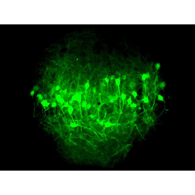 Microscope/Telescope Adapter for iPhone X