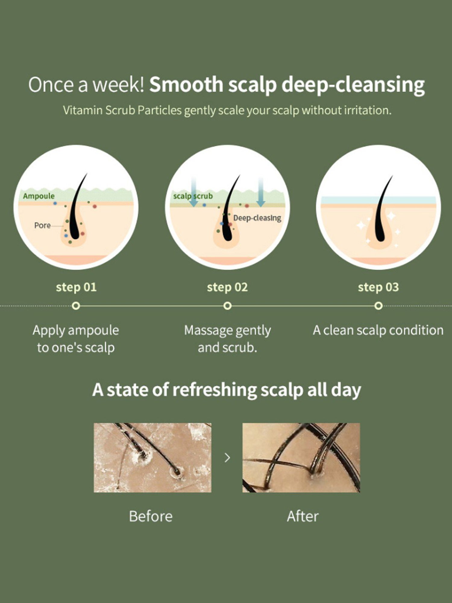 Lador Scalp Scaling Spa - 15 gm