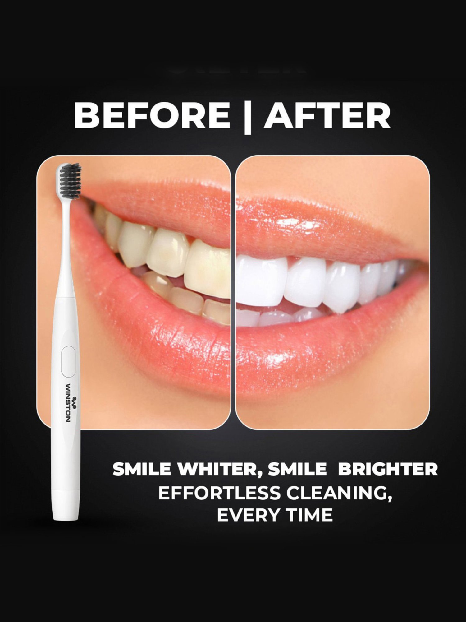 Winston Sonic Electric Toothbrush with Charcoal Bristles AAA Battery Operated (White)