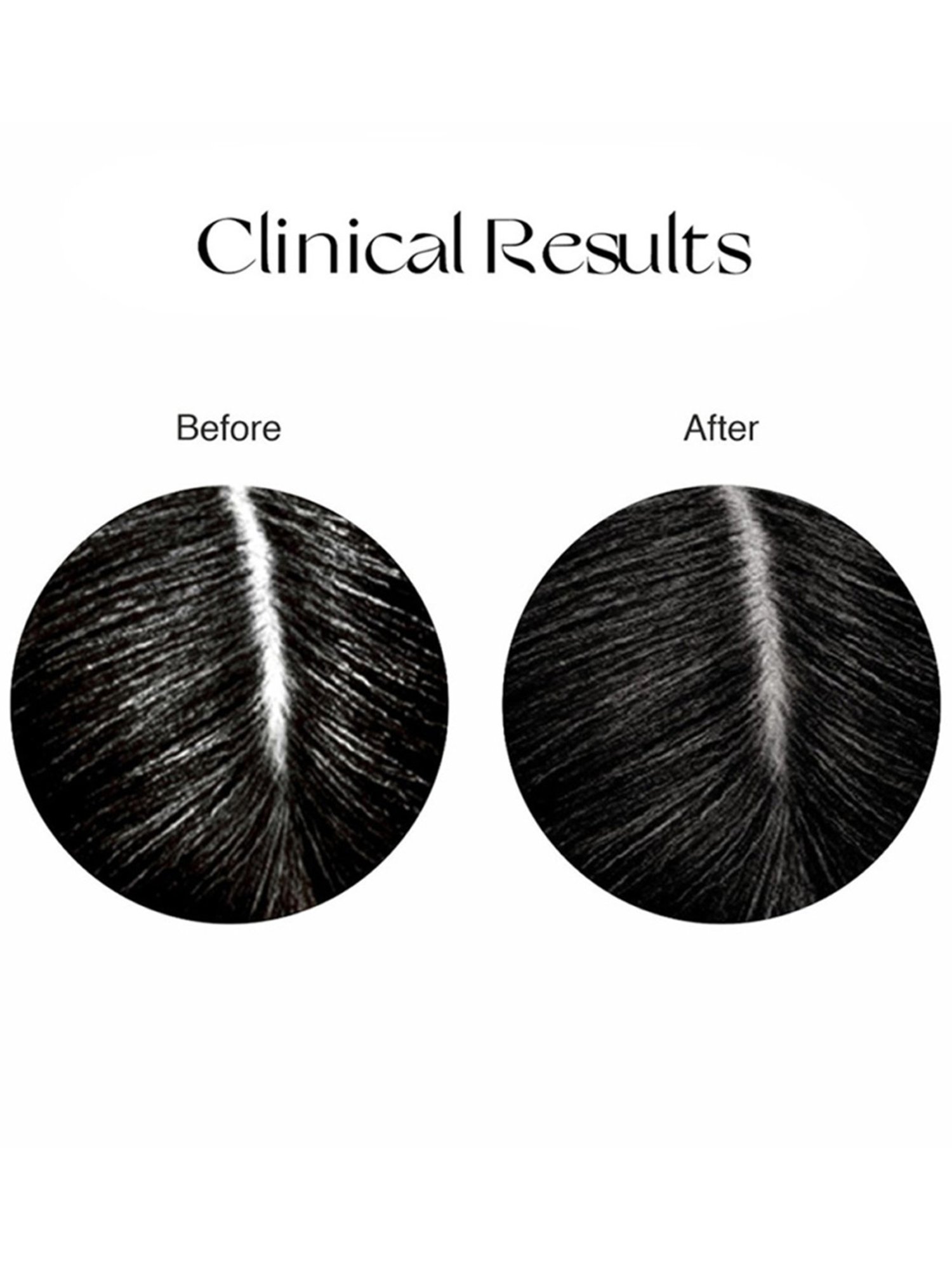 Nourish Mantra Rice Water Hair Serum - 50 ml