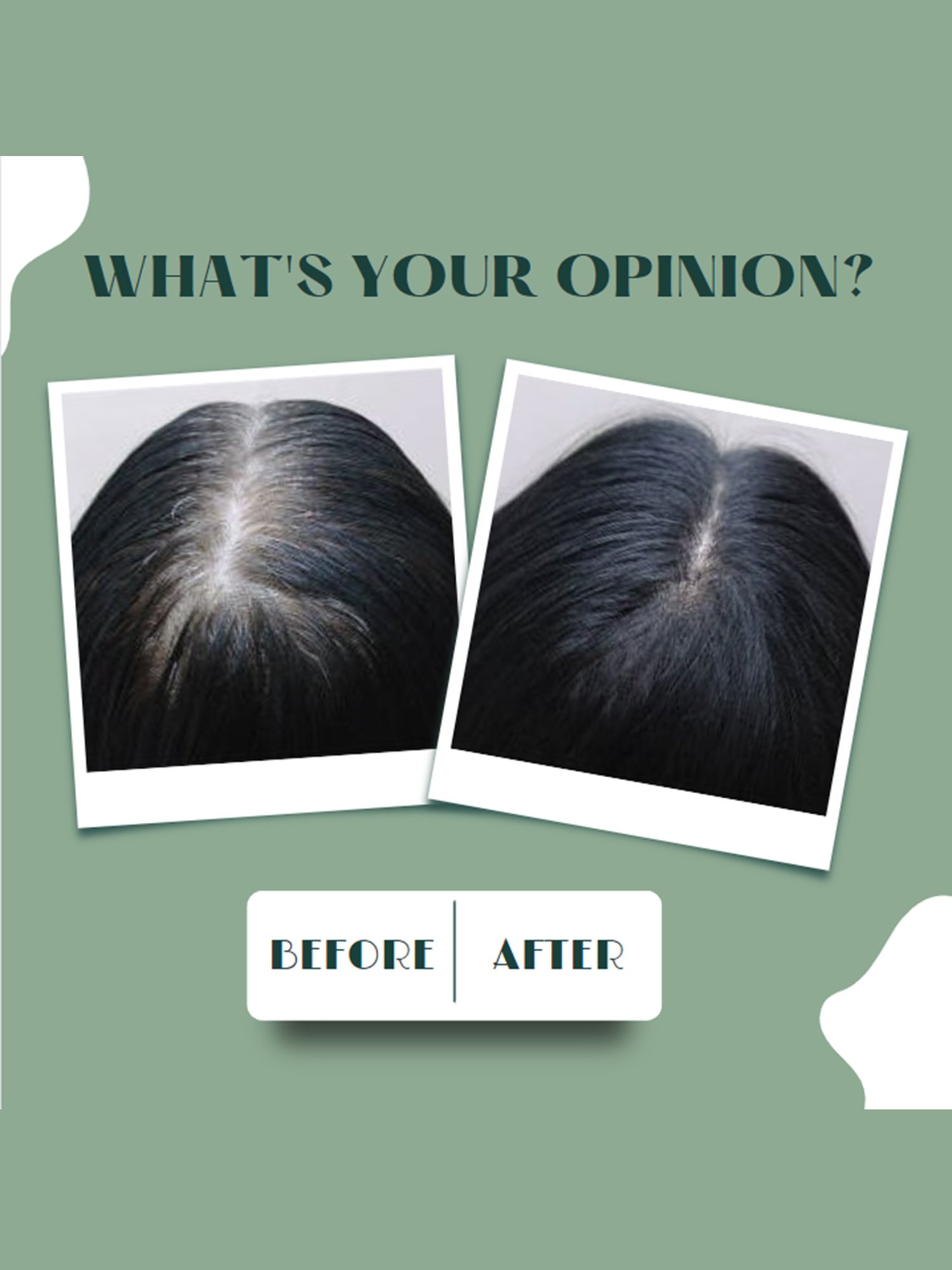 L'Oreal Pari Casting Creme Gloss Conditioning Hair Colour 400 Dark Brown - 87.5 gm + 72 ml