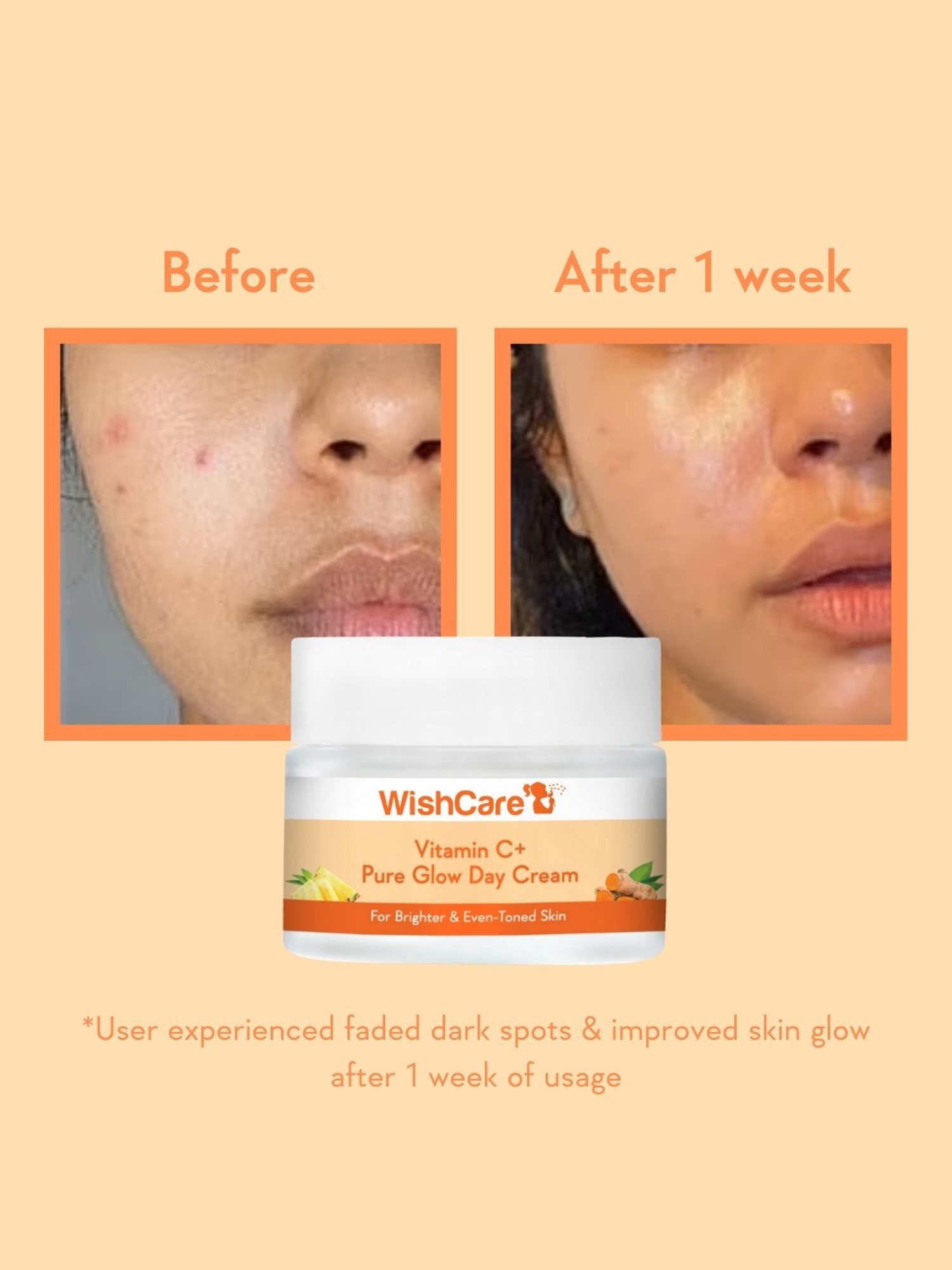Wishcare Vitamin C+ Pure Glow Day Cream - 50 gm