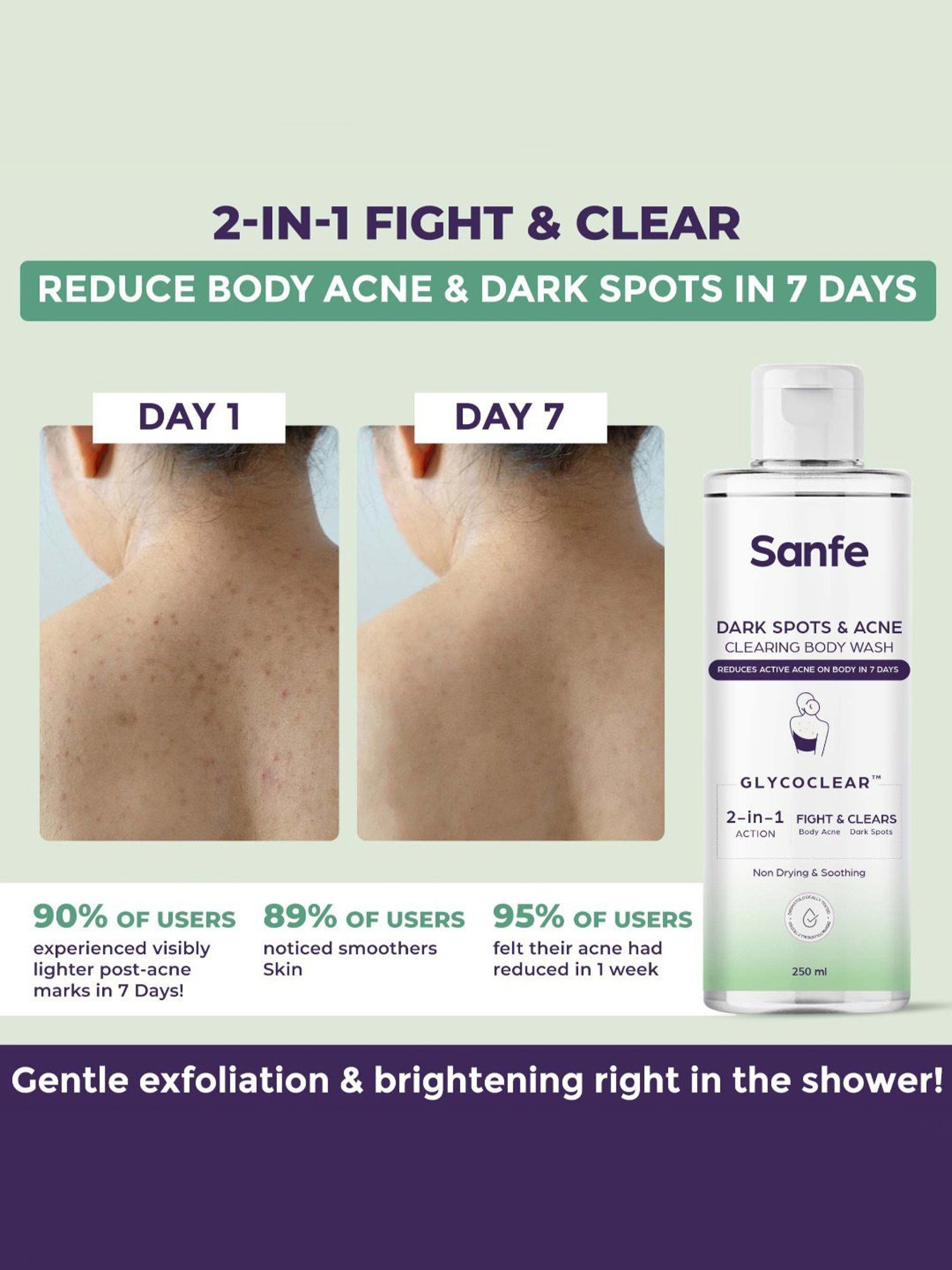 Sanfe Dark Spots & Acne Clearing Body Wash - 250 ml