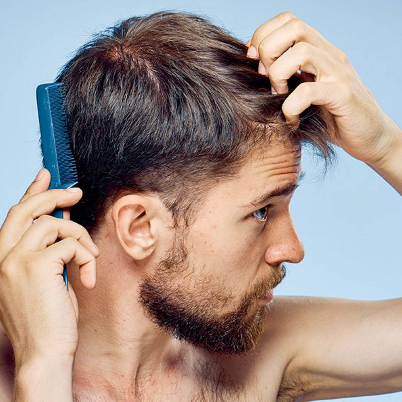 Men's Rogaine Extra Strength 5% Minoxidil Solution - 2 fl oz