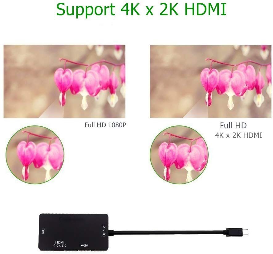 Mini DP to HDMI VGA DVI, ESTONE 3 in 1 Gold Plated Mini DisplayPort (Thunderbolt) Adapter Compatible with MacBook, iMac, Mac Book Air, DP Version 1080P, (1080P, White)