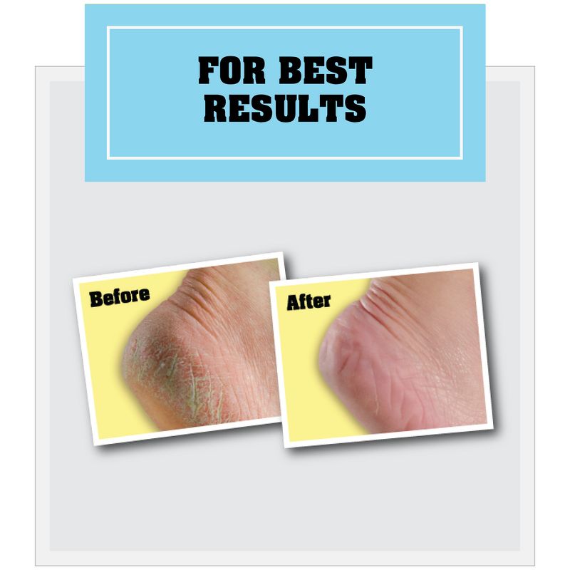 O'Keeffe's Healthy Feet Jar 2.7oz