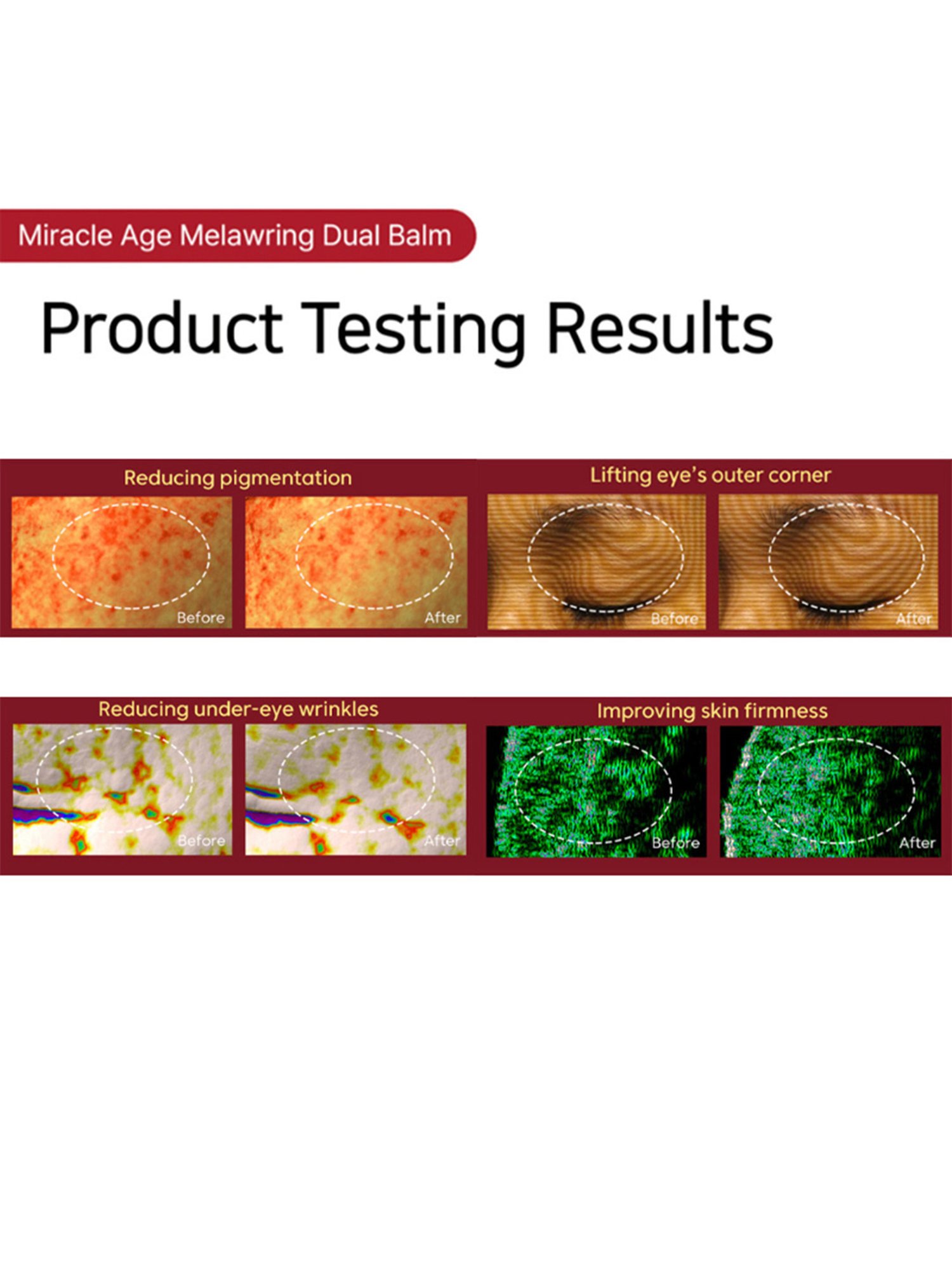 Thank You Farmer Miracle Age Melawring Dual Balm - 10 gm