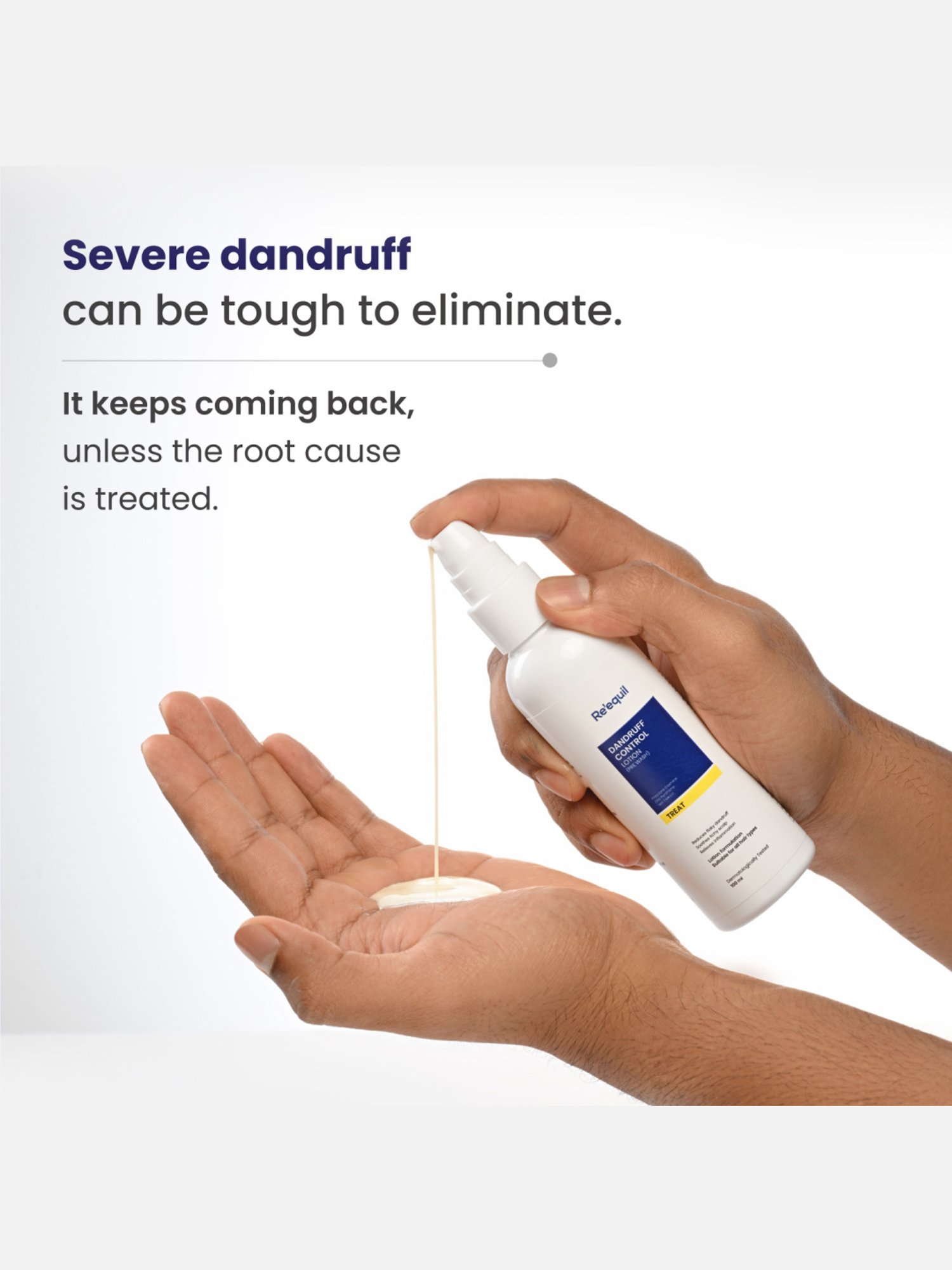 Re'equil Dandruff Control Lotion - 100 ml