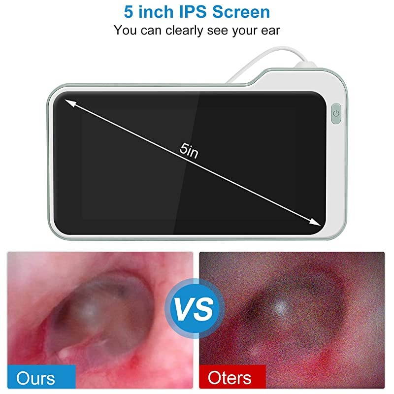 39mm Ear Inspection Camera with 5 inch IPS Screen Digital Otoscope with Earwax Removal Kit Tools Ear Scope Cleaning Tool