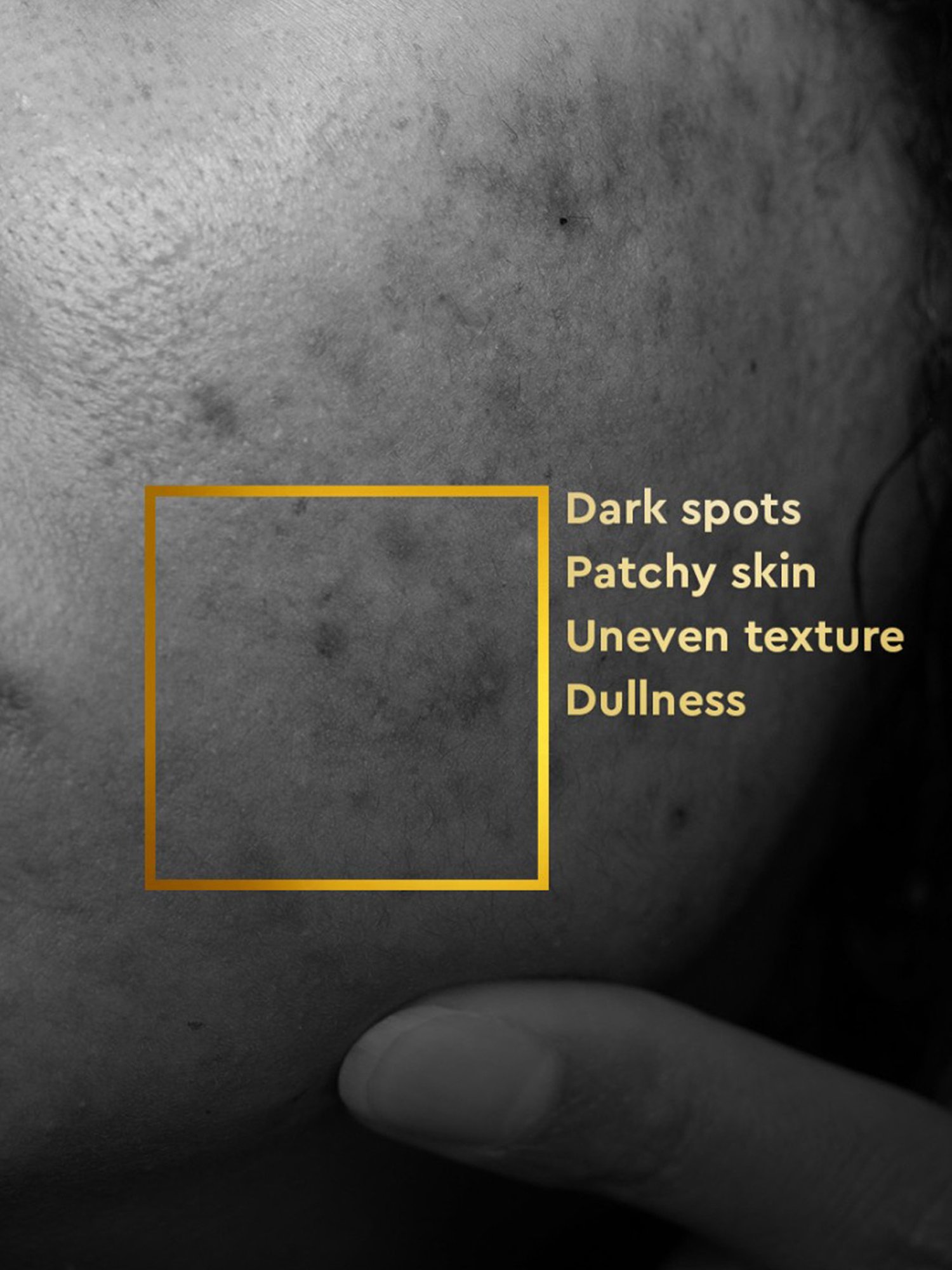 VLCC Clinic ProBright Micro Serum & Cica Cream Combo