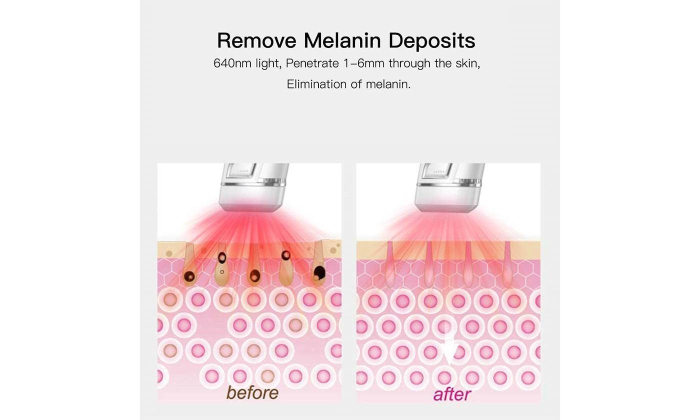 Electric Depilator Epilators Body Hair Face Removal 5 Mode Laser Skin Whitening