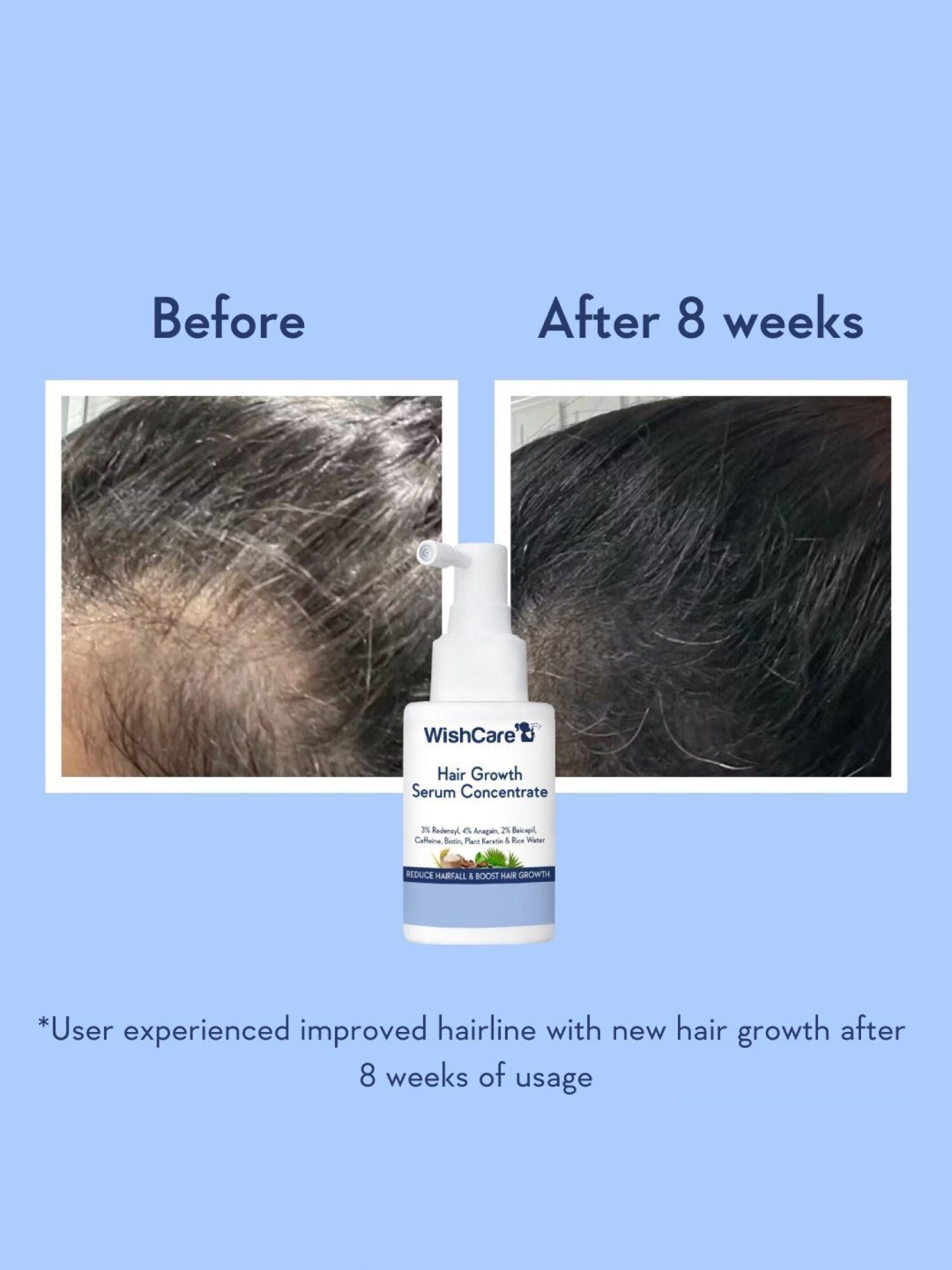 Wishcare Hair Growth Serum Concentrate - 30 ml