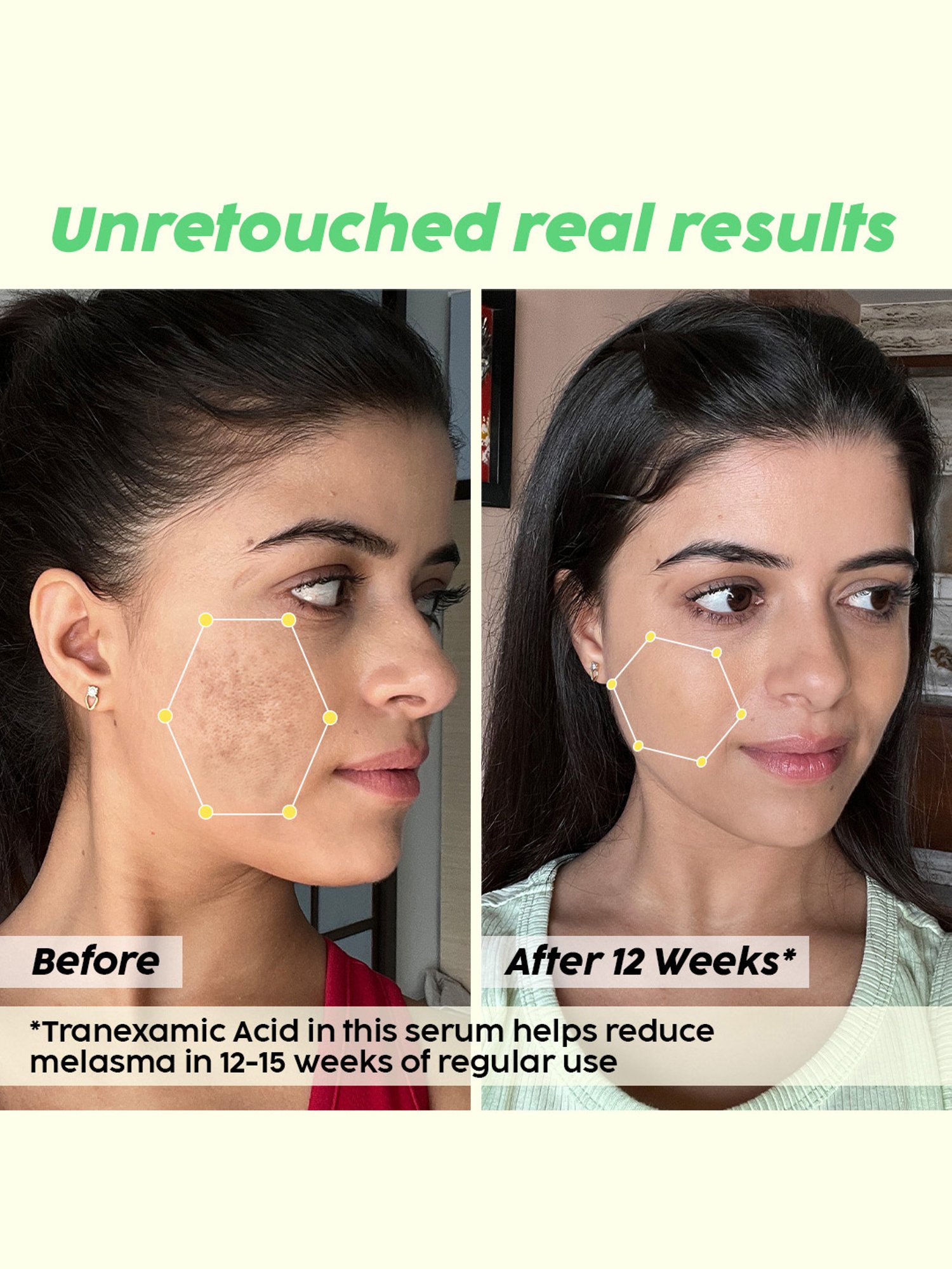 PLIX THE PLANT FIX Pineapple Skin Perfecting Dewy Serum - 30 ml