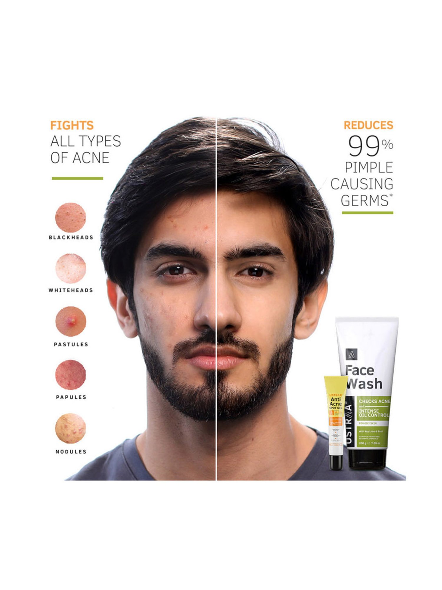 Ustraa Ayurvedic Cold Pressed Oil - 200 ml & Anti Acne Spot Gel - 15 ml