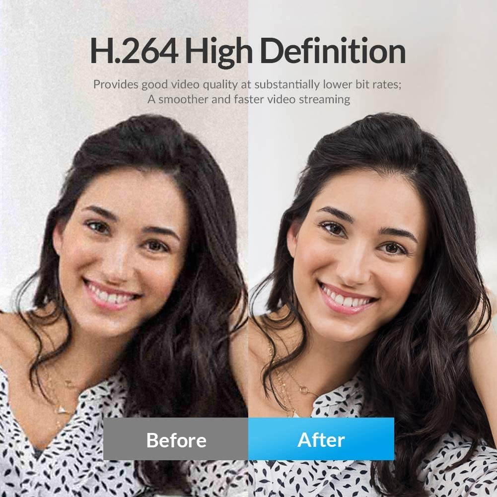 Angetube Streaming 1080P HD Webcam Built in Adjustable Ring Light and Mic. Advanced autofocus AF Web Camera for Google Meet Xbox Gamer Facebook YouTube Streamer