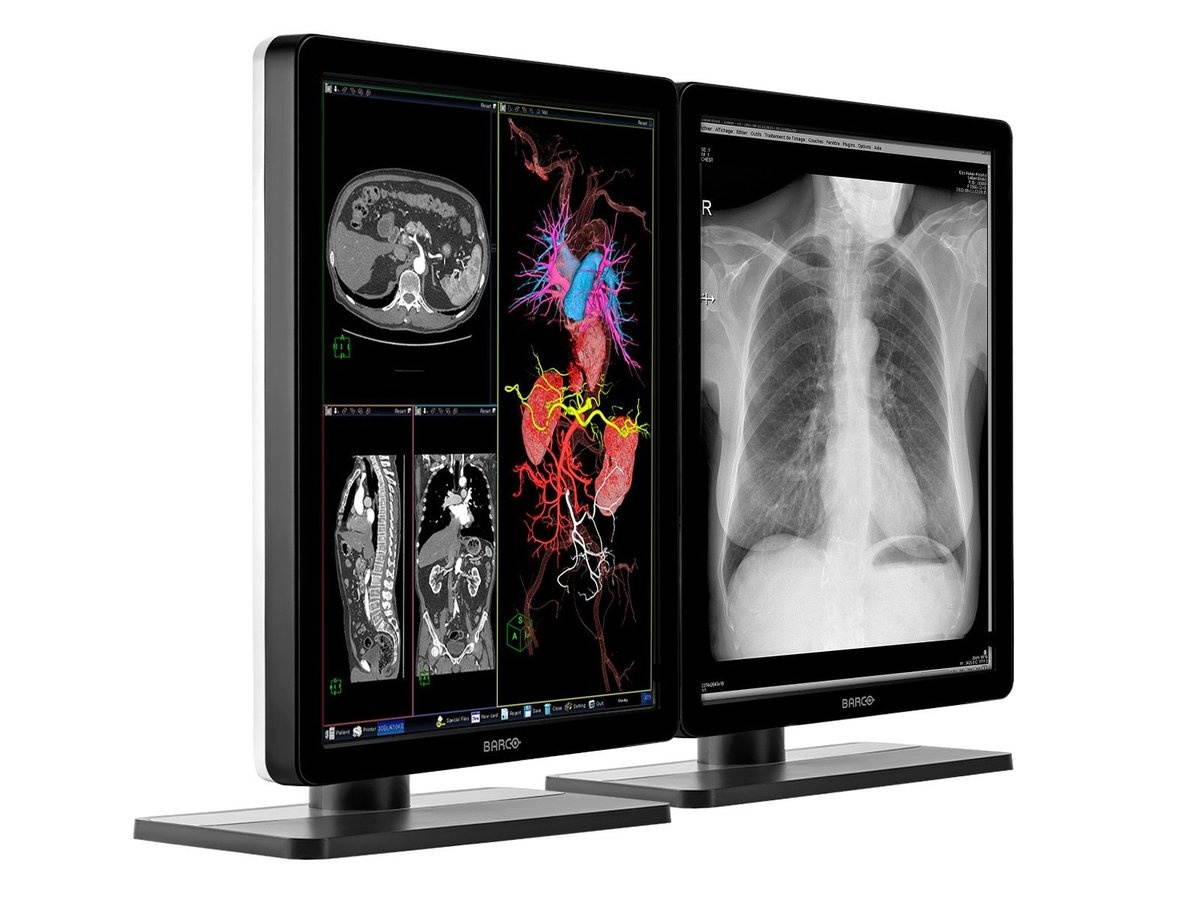 Pair (x2) Barco Nio MDNC-3421 3MP 21'' Color LED General Radiology PACS Display (K9300340A)