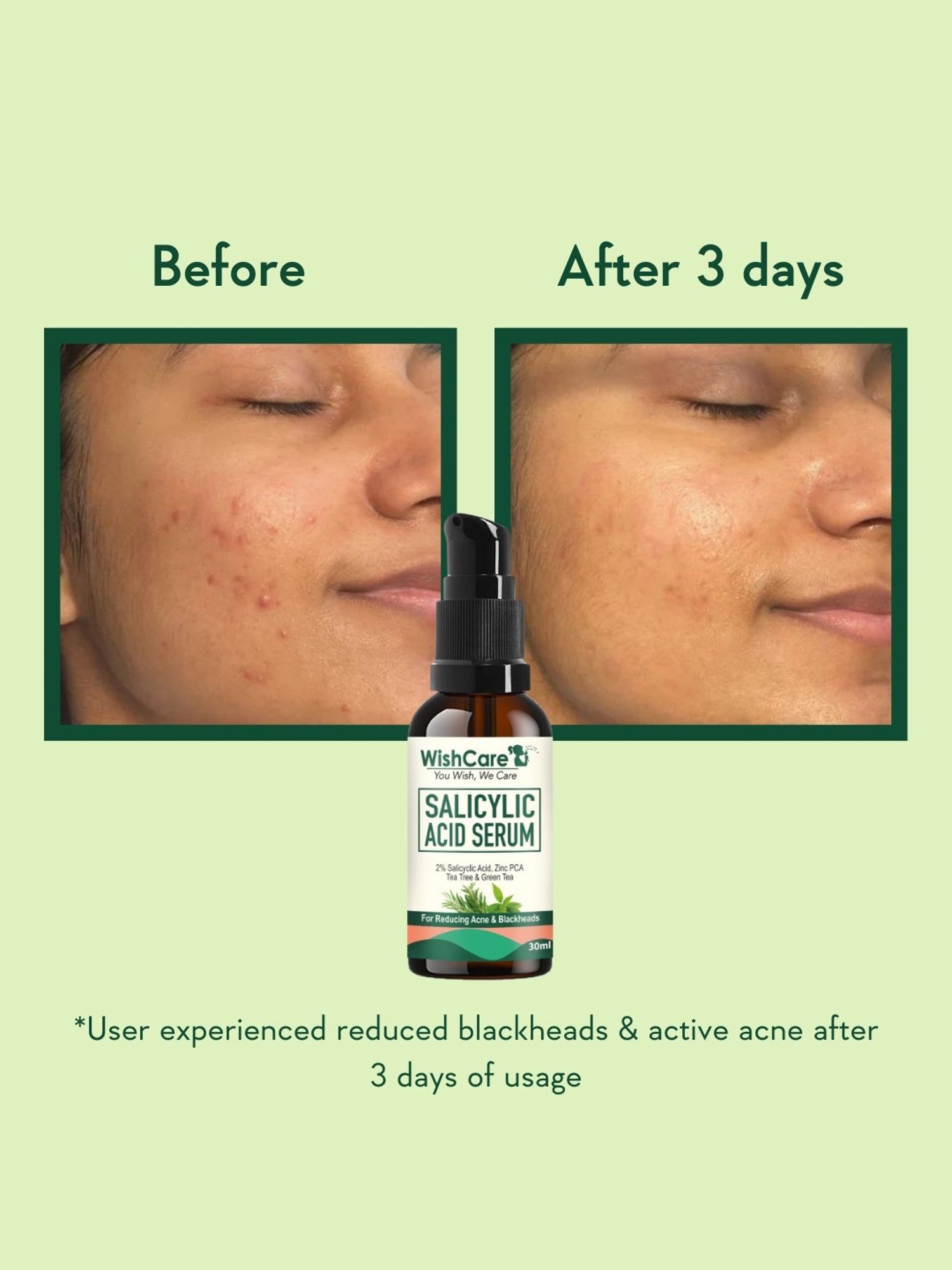 Khadi Essentials 20% Vitamin C Face Serum with Grapefruit for Toned & Bright Skin - 30 ml