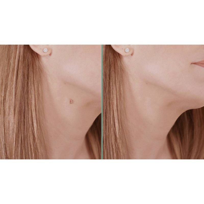 SLMD Skincare Glycolic Acid Body Scrub - 6oz