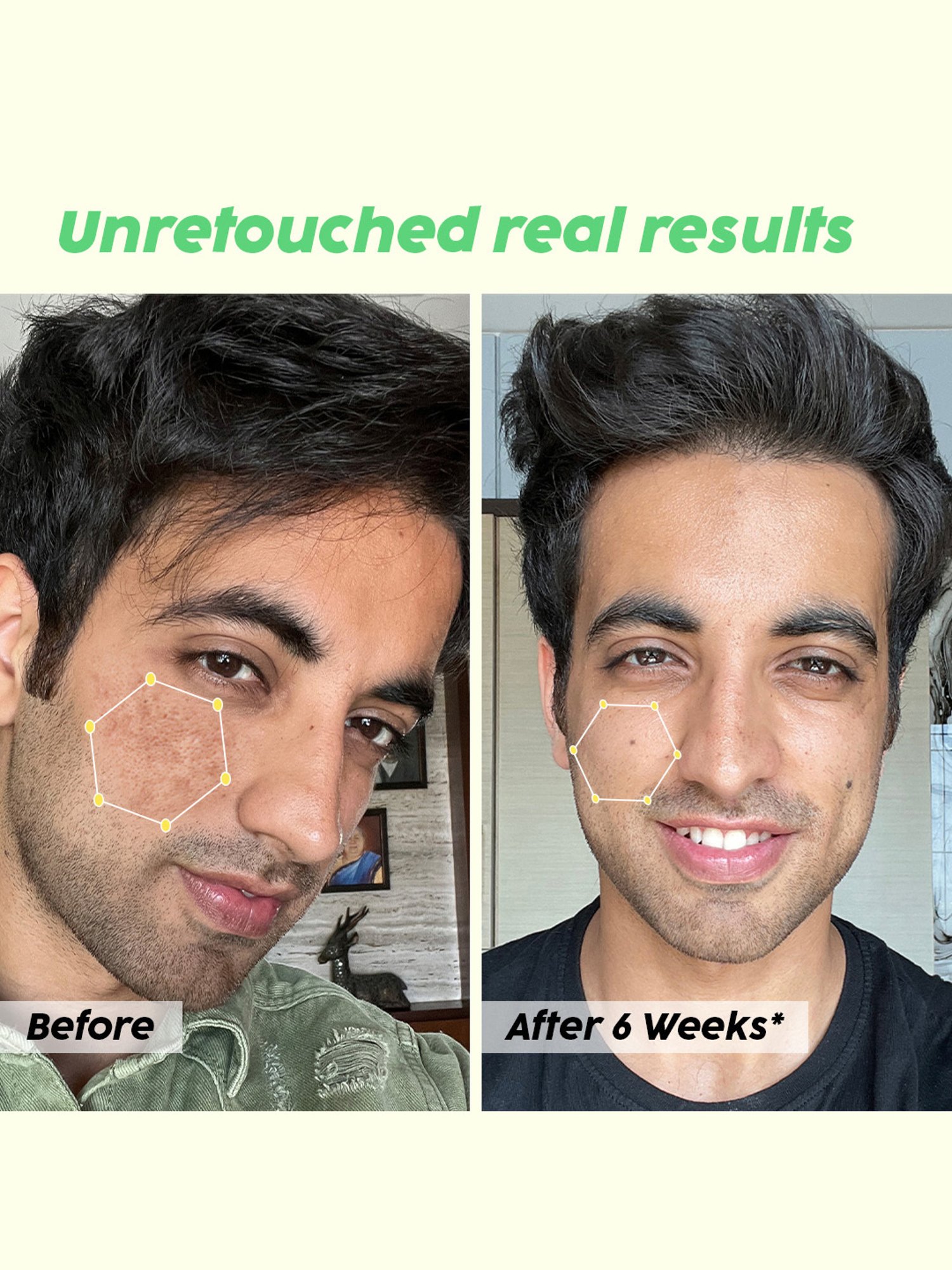 PLIX THE PLANT FIX Jamun Active Acne Control Dewy Serum - 30 ml