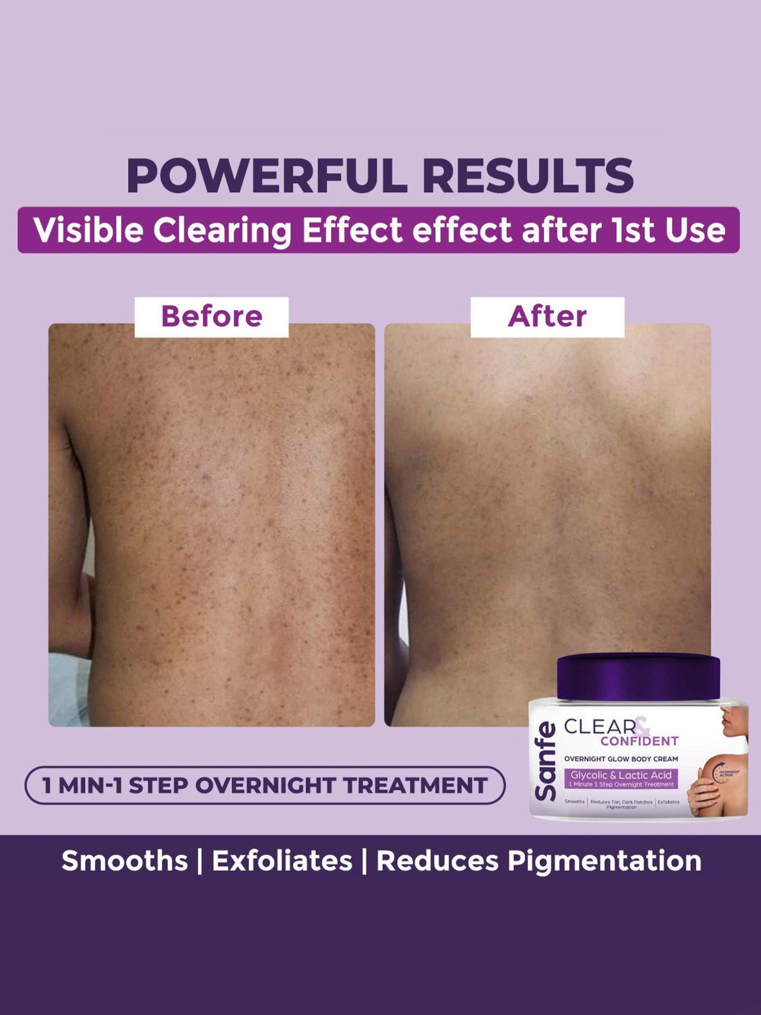 Sanfe Clear & Confident Overnight Glow Body Cream - 100 gm