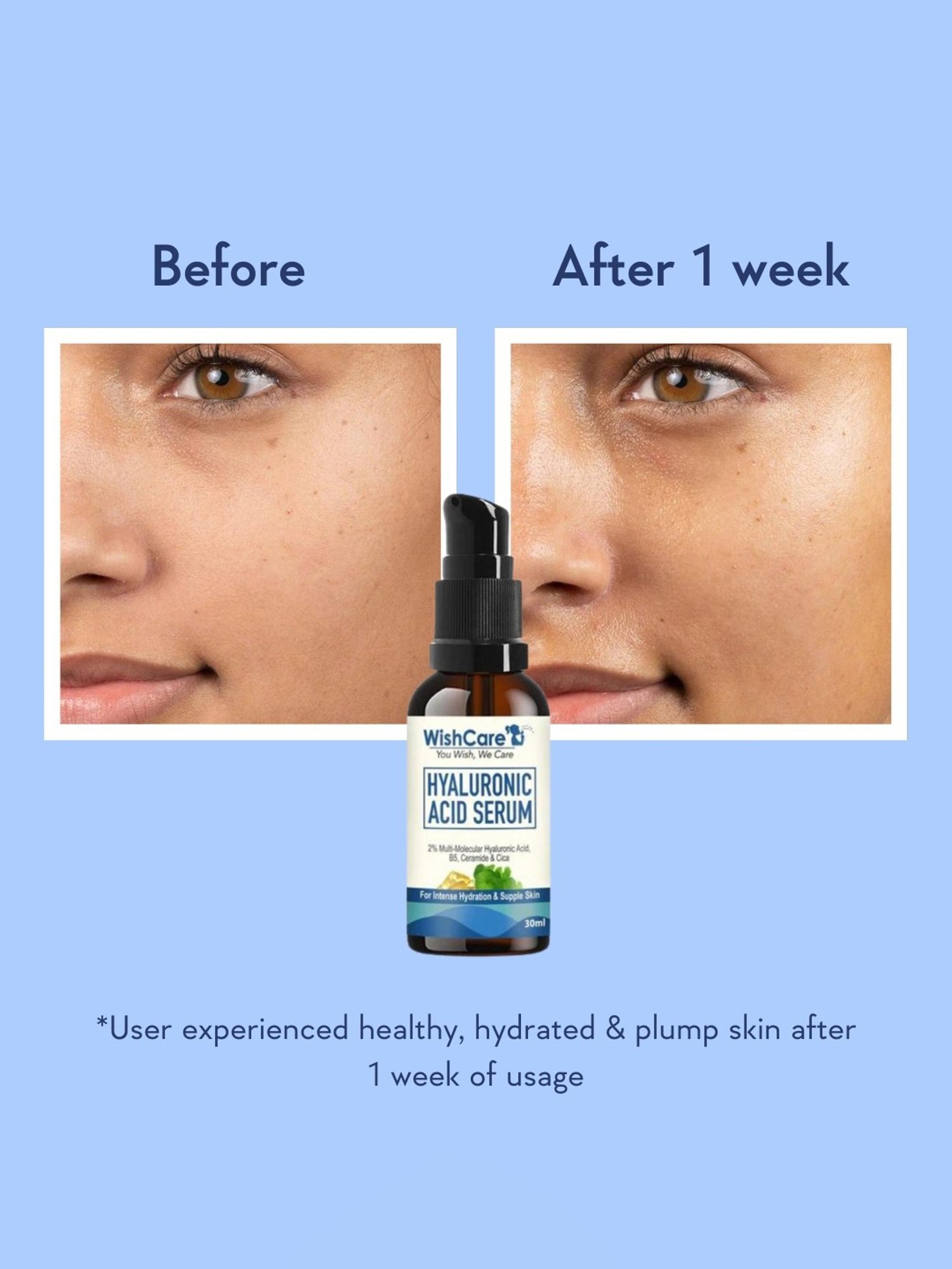 Wishcare Hyaluronic Acid Serum - 30 ml