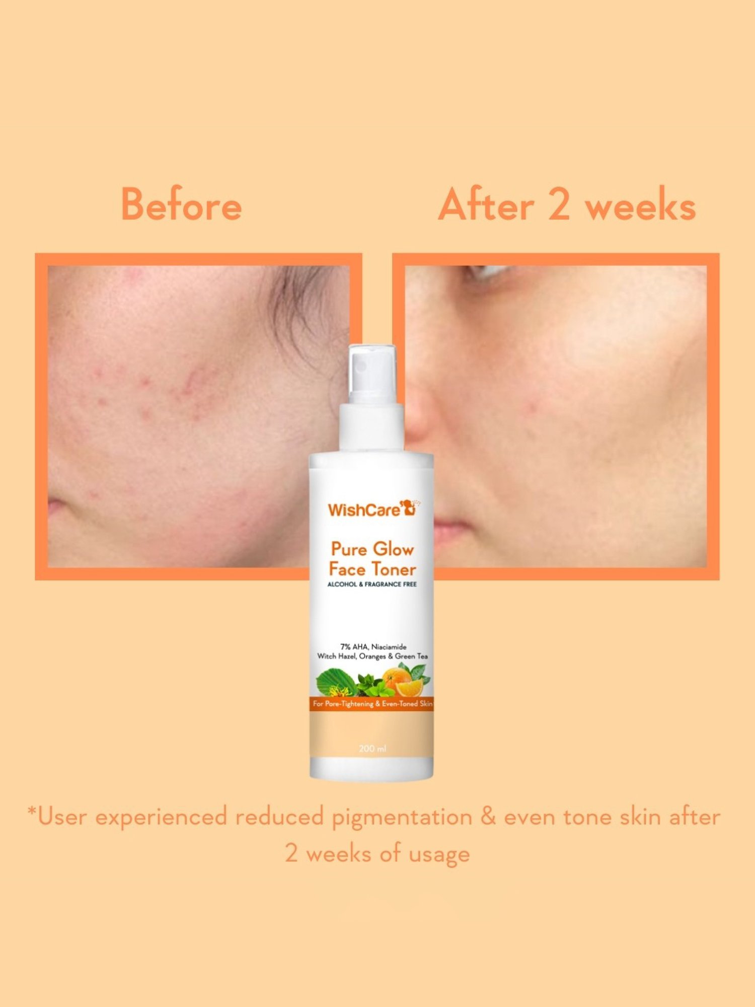 Wishcare Pure Glow Face Toner - 200 ml