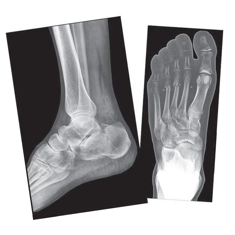Roylco Broken Bones X-Rays