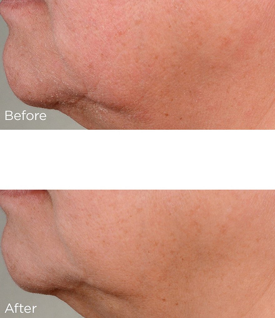 Perricone MD High Potency Classics Growth Factor Firming & Lifting Serum