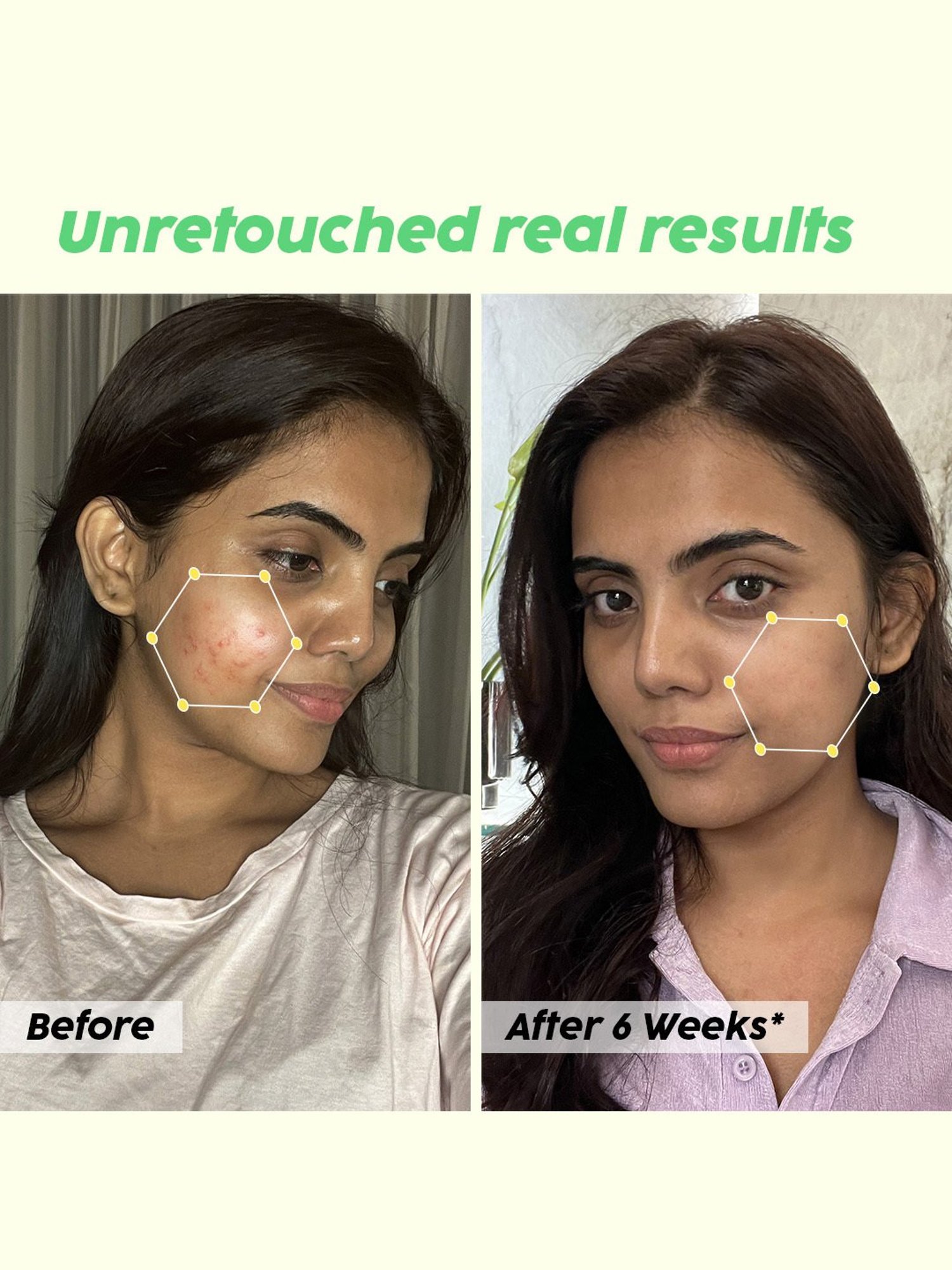 PLIX THE PLANT FIX Jamun Active Acne Control Dewy Serum - 30 ml