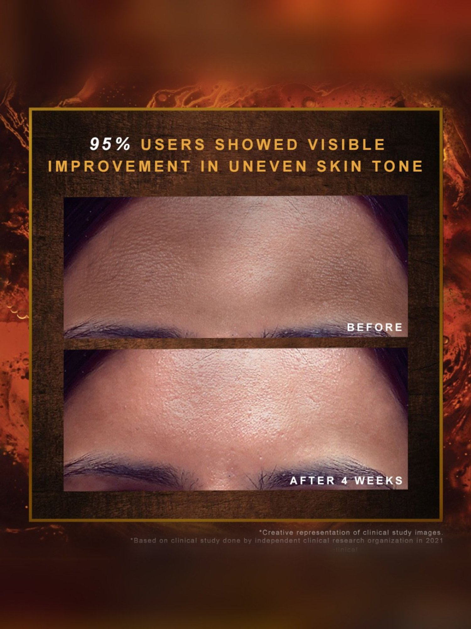 Indulekha Ayurvedic Proprietary Medicinal Soap - Pack of 3