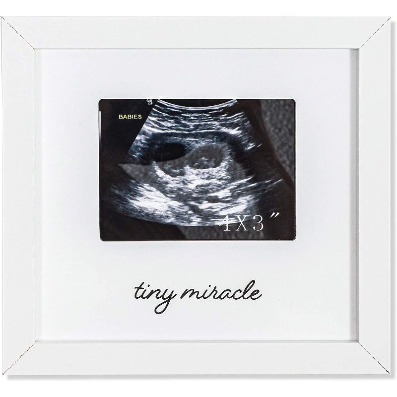 Juvale White Sonogram Keepsake PictureFrame for 4 x 3 Ultrasound Photos (7 x 6.5 Inches)