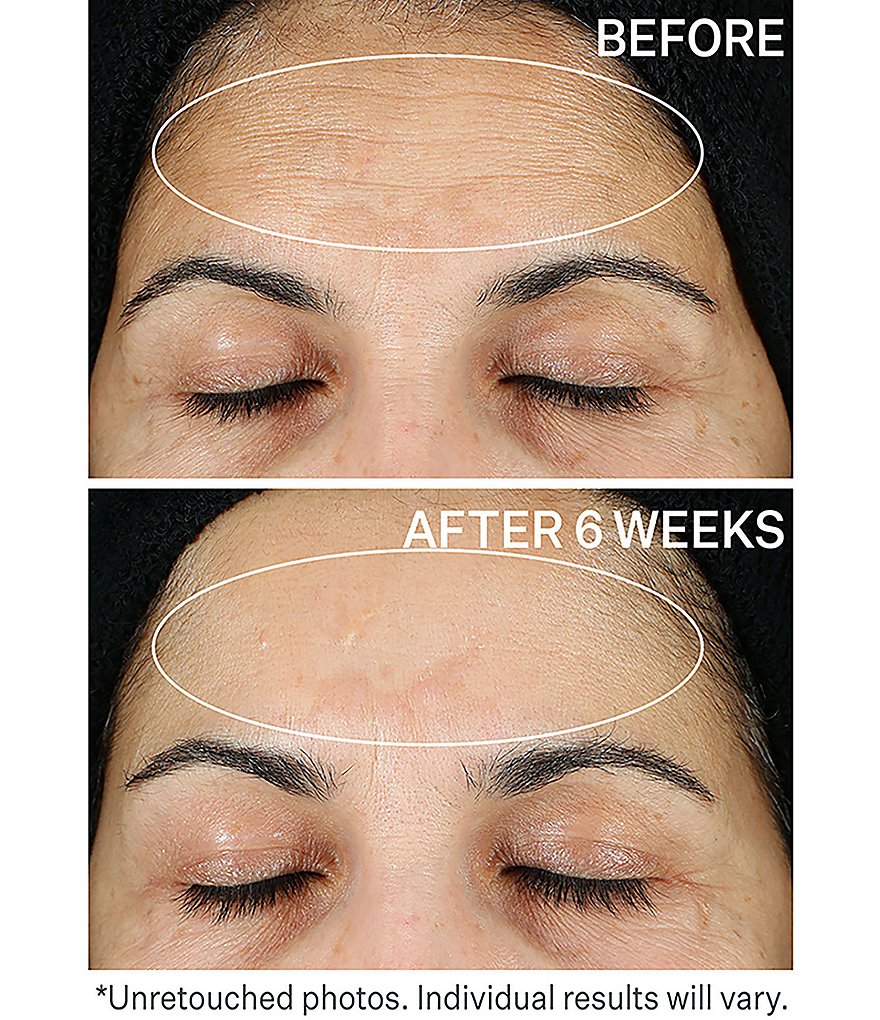 StriVectin SUPER-C RETINOL Brighten & Correct Vitamin C Serum