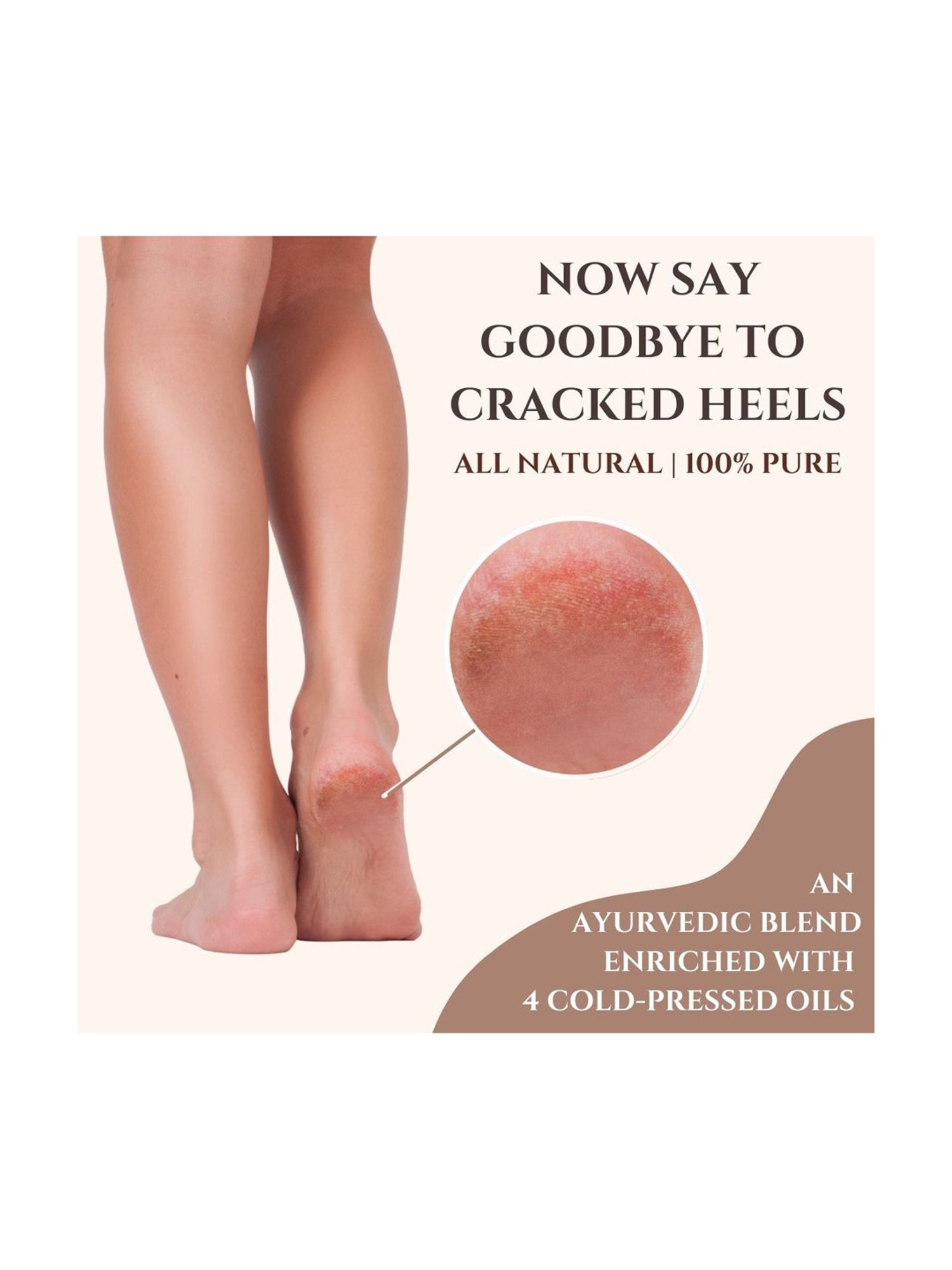 Essentia Extracts Cracked Heel & Elbow Repair Oil (Pack of 2) - 200 ml