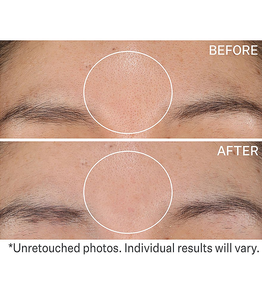 StriVectin DAILY REVEAL&trade; Exfoliating Pads