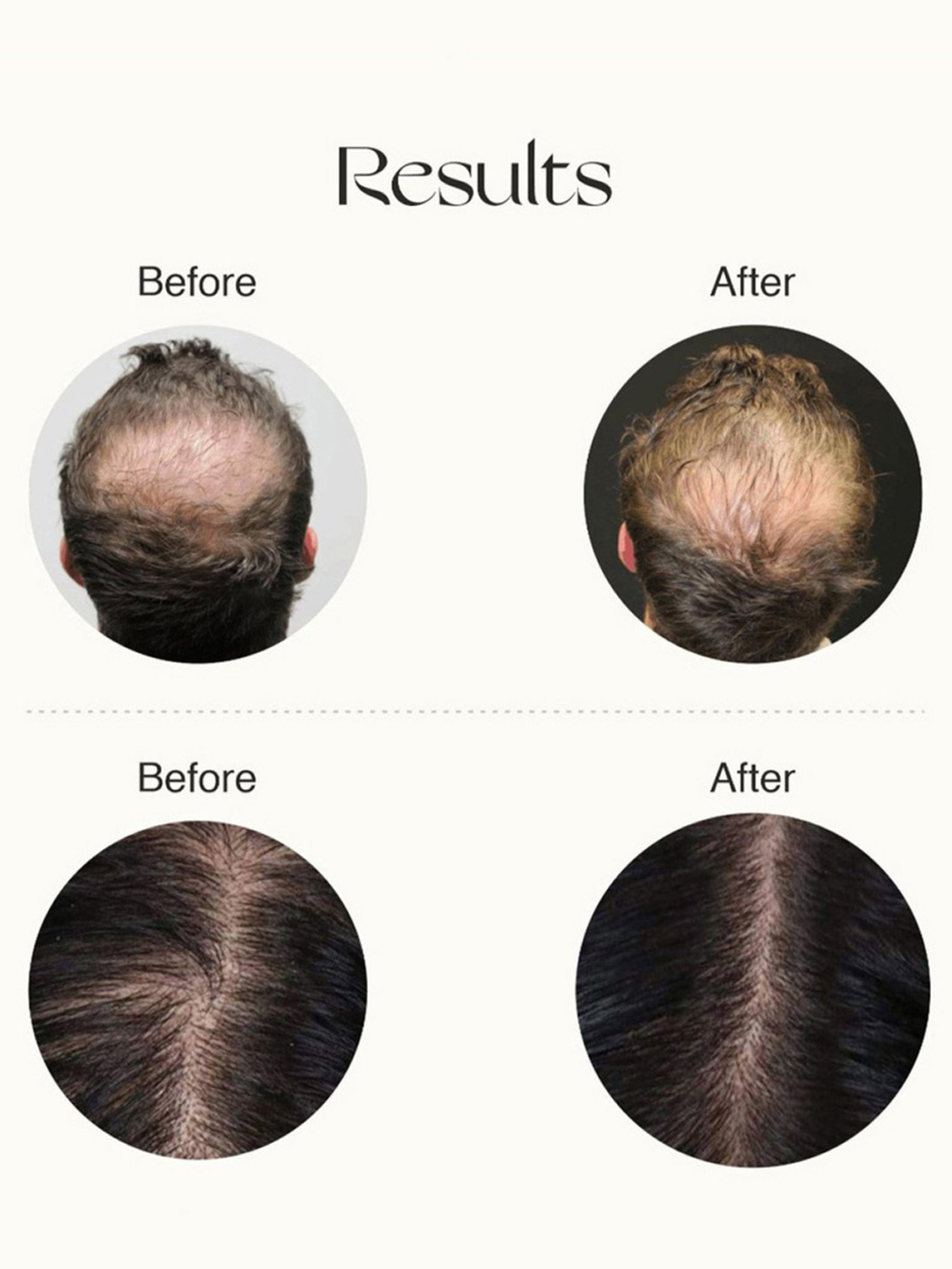 Nourish Mantra Advanced Hair Growth Serum - 50 ml