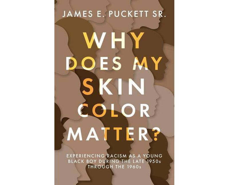 Why Does My Skin Color Matter? - by  James E Puckett (Paperback)