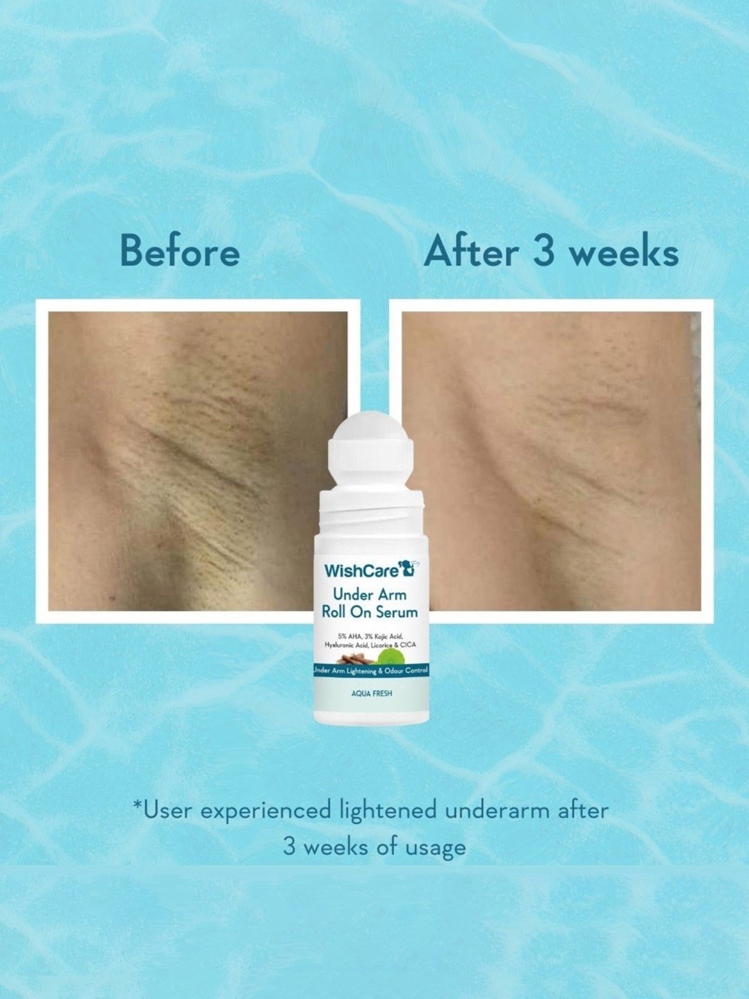 Sirona 2-in-1 Underarm Deodorant Roll On - 50 ml