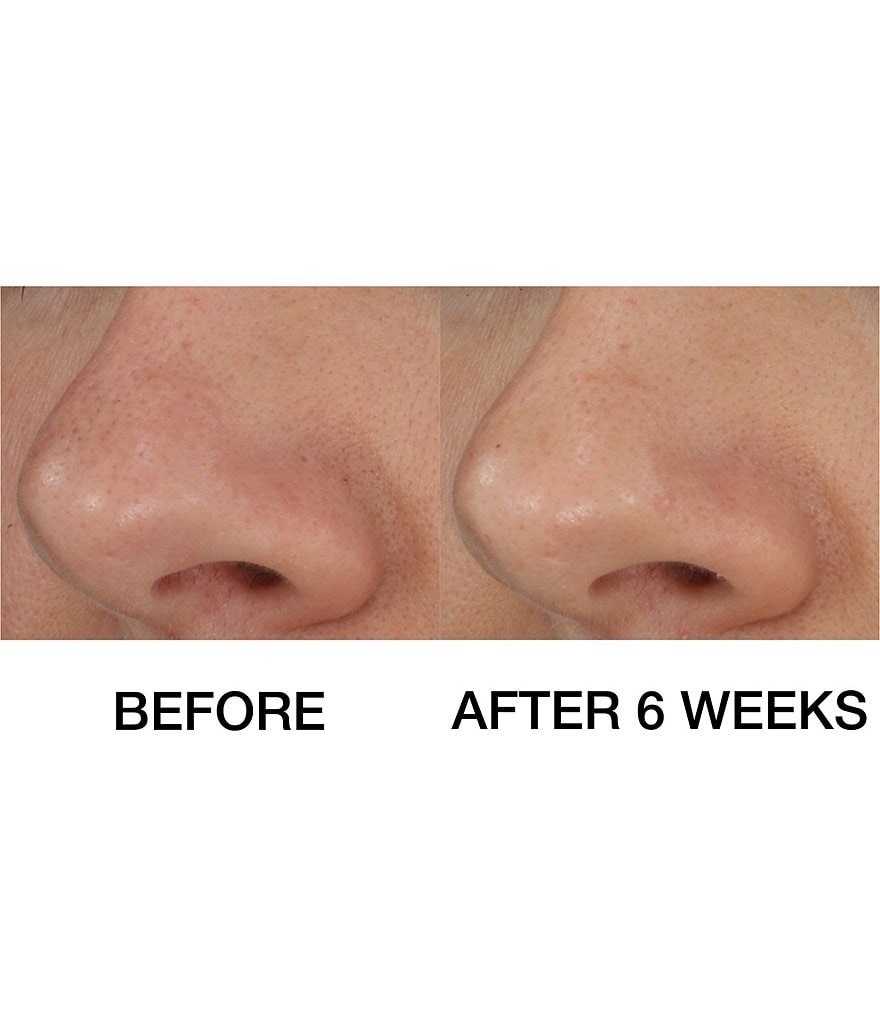 StriVectin Super-B Barrier Strengthening Oil