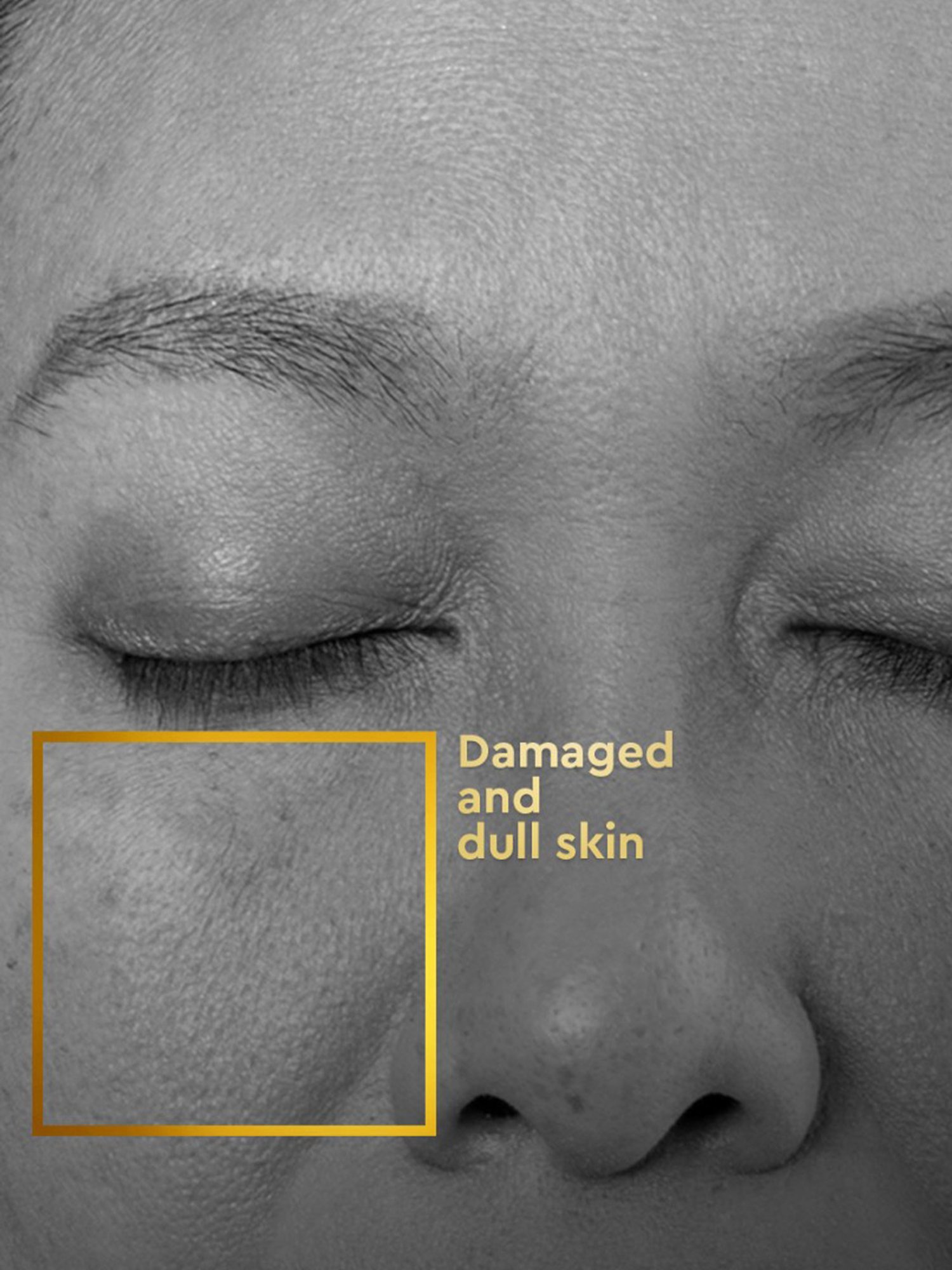 VLCC Clinic ProRescue Bio Cream - 100 gm