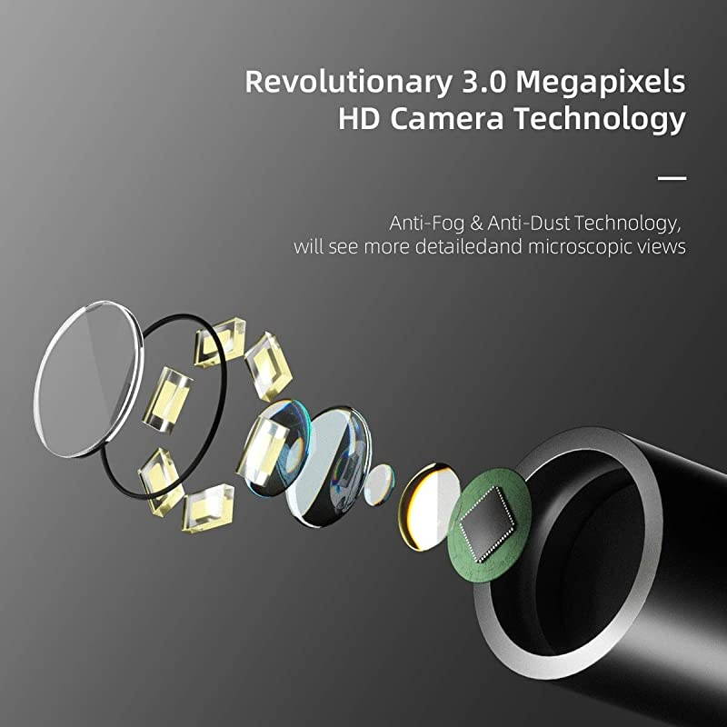 M9 Pro Otoscope Smart Visual Ear Cleaning Stick with 1080P HD Digital Endoscope for Earwax Cleaning Received A 4axis Intelligent Gyroscope Red