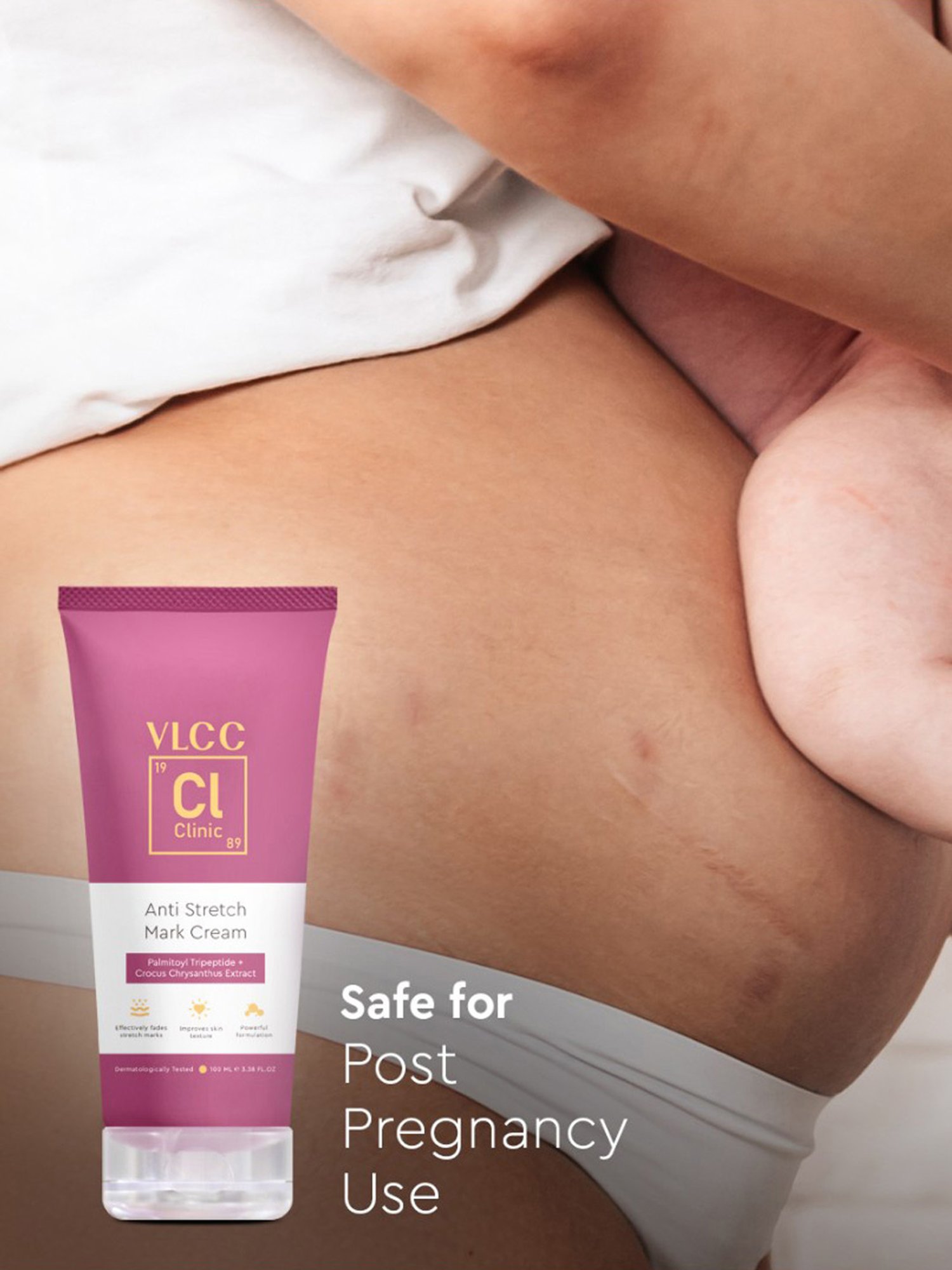 Mom & World Skin Bio Therapy Oil For Stretch Marks - 200 ml