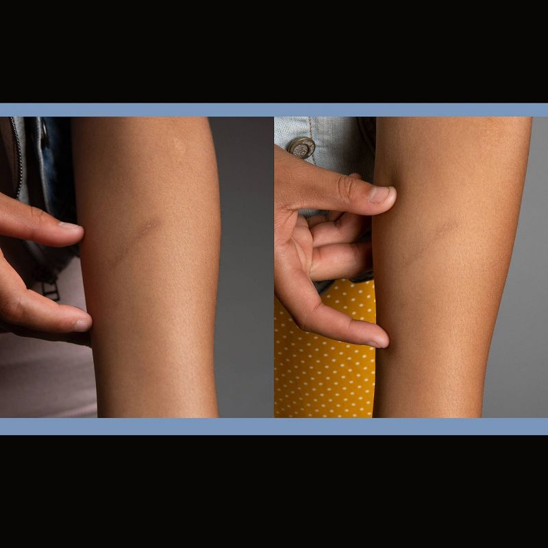 ScarAway Scar Treatment Sheets - 8ct