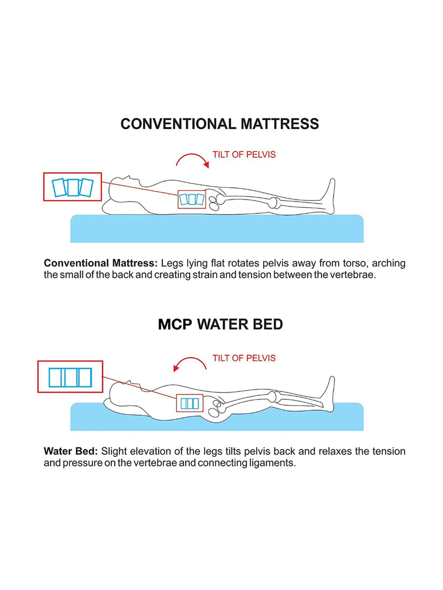 Rossmax EB100 Stethoscope (Black)
