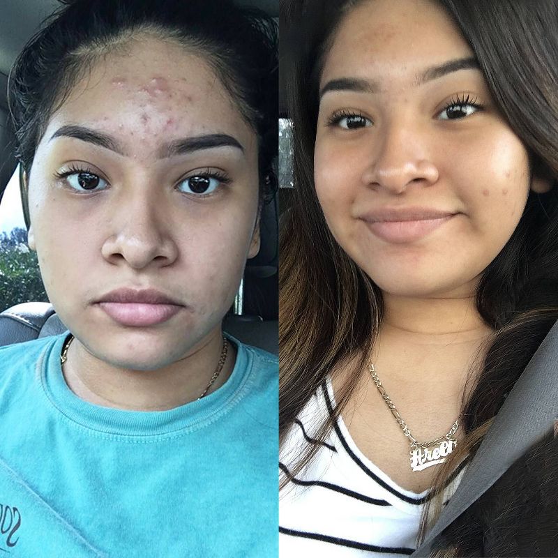 Origins Original Skin&trade; Cleansing Makeup Removing Jelly with Willowherb